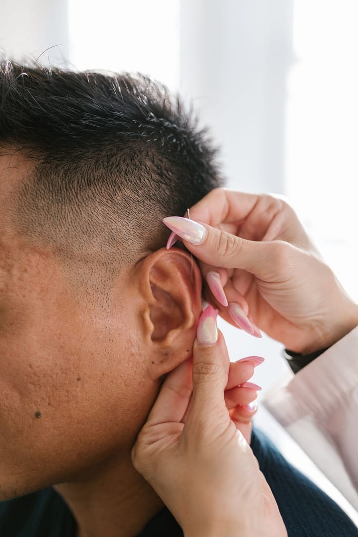 Auriculoterapia dói? O que você realmente sente durante e depois