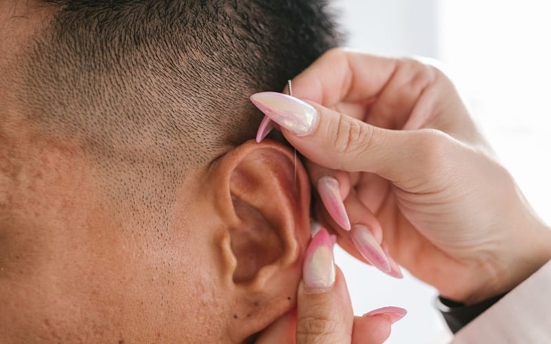 Auriculoterapia dói? O que você realmente sente durante e depois