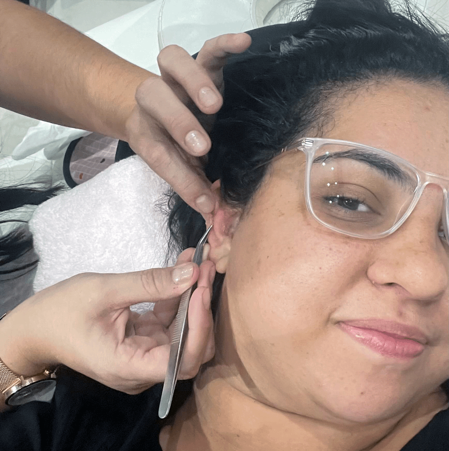 Auriculoterapia na síndrome pré-menstrual